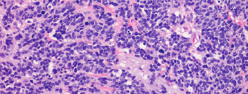 Stained MCC cells